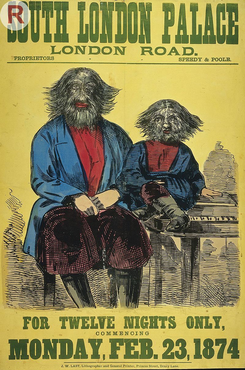 多毛症の見世物、ロンドン、1874年