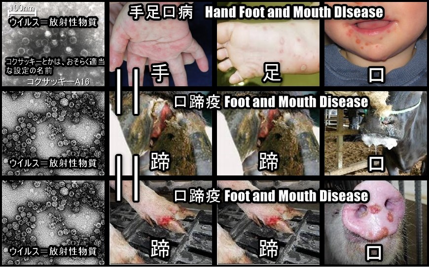 手足口病は口蹄疫 放射性物質の害　各国の原発の周辺に多い